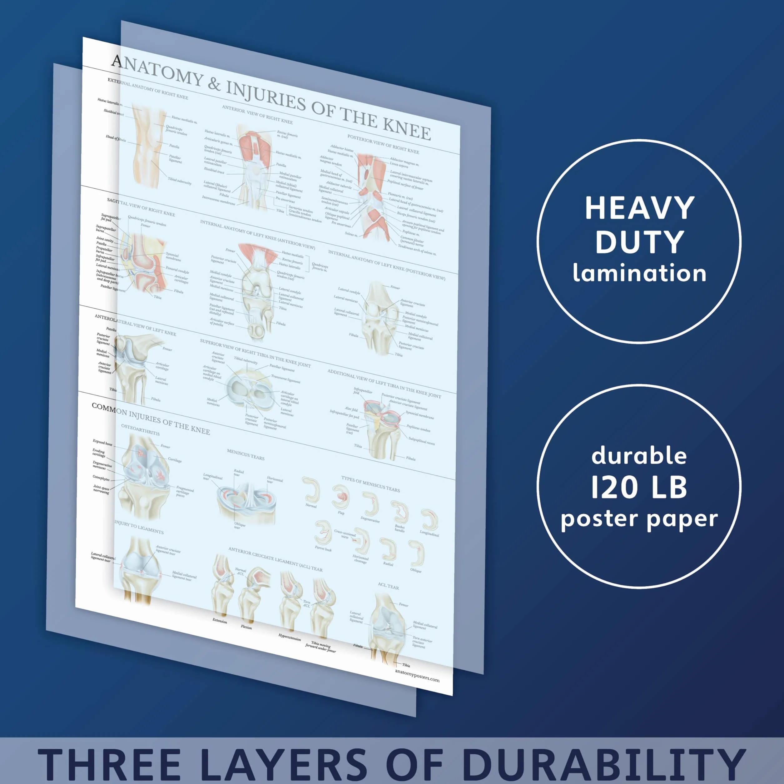 Palace Learning Zestaw 2 plakatów anatomia kolana i ramion – wykresy anatomiczne laminowany 45 cm x 61 cm